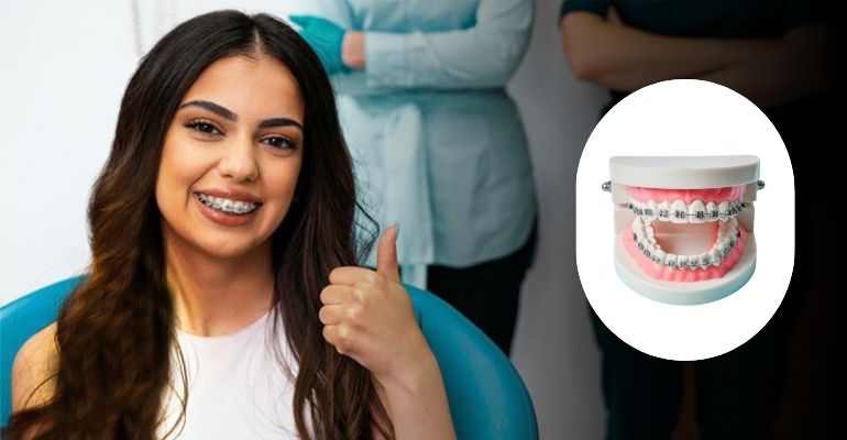Braces Treatment In Nadiad