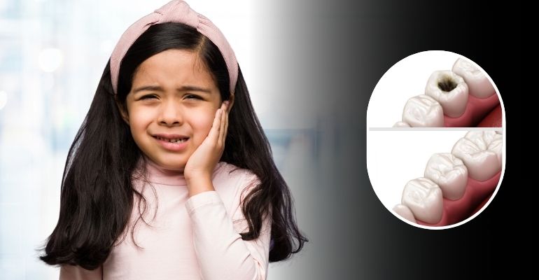 cavity filling in Nadiad