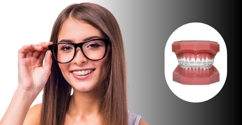 Ceramic Braces Treatment In Nadiad