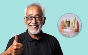 Dental-Implants