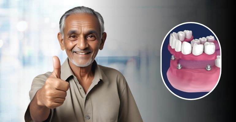 Full Mouth Reconstruction in Nadiad