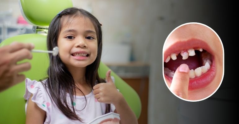 Kids Dental Treatment In Nadiad