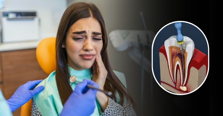root canal treatment in Nadiad