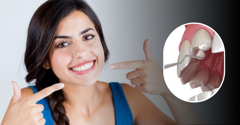 Smile Makeover Treatment in Nadiad