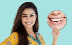 Smile-Makeovers