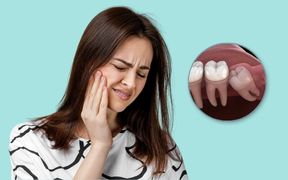 Wisdom-Tooth-Removal
