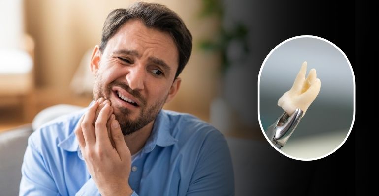 Wisdom Tooth Removal Treatment In Nadiad