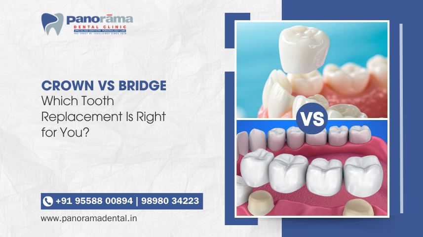 dental crown & bridge in nadiad
